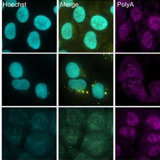 DNase treatment abolished cytoplasmic puncta detected by RNA FISH. U2OS ...