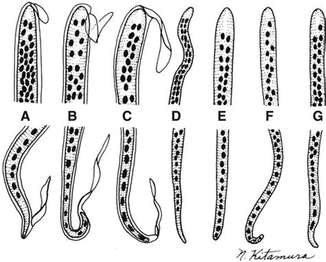 Blood and Tissue (Filarial) Nematodes | Basicmedical Key