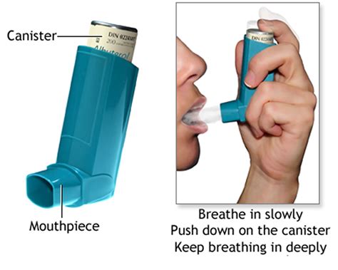 Asthma Attack Causes, Allergy, Triggers - Symptoms, Treatment Inhalers