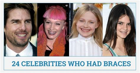 24 Celebrities Who Had Braces | Famous People with Braces