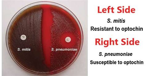 Optochin Susceptibility Test- Principle, Procedure and Results ...