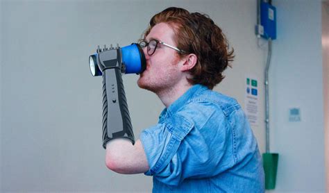 A student's low-cost 3D printed prosthetic arm provides tactile ...