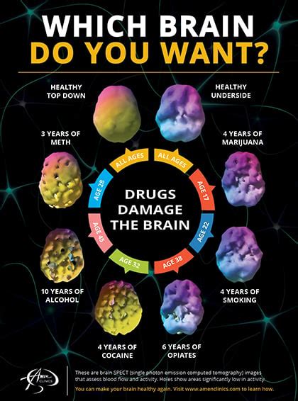 Brain Scan On Drugs - Brain Mind Article