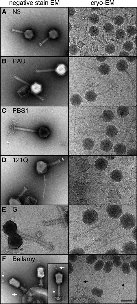 Bacteriophage Electron Microscopy