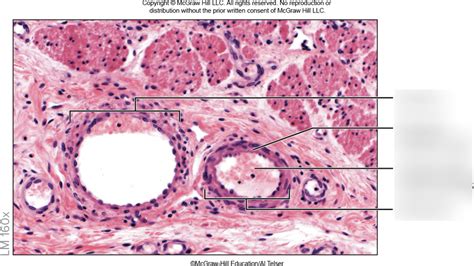 Artery vs vein histology Diagram | Quizlet