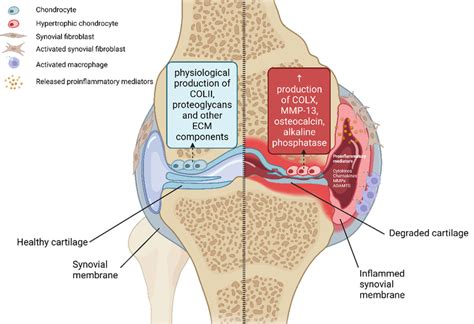 Structural and molecular changes during OA process. Chondrocytes ...