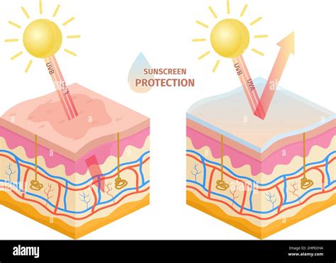 Human skin uv rays protection, before and after sunscreen. Sun uva, uvb ...