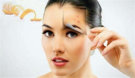 12 Effective Face Mask for Acne Scars ~ Natural Homemade Face Mask For ...