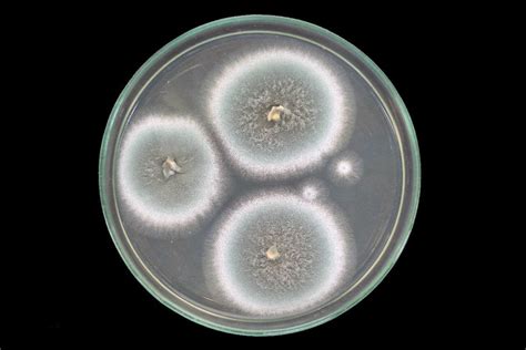 Aspergillus fumigatus: qué es, características, morfología y enfermedades