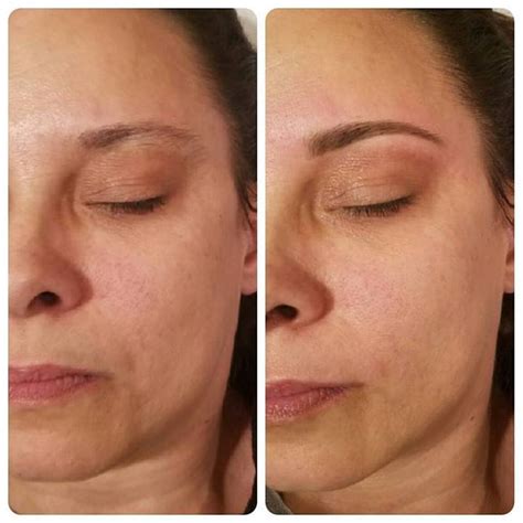 Before and after brow wax! #dayton #ohio #brazilianwaxing # ...