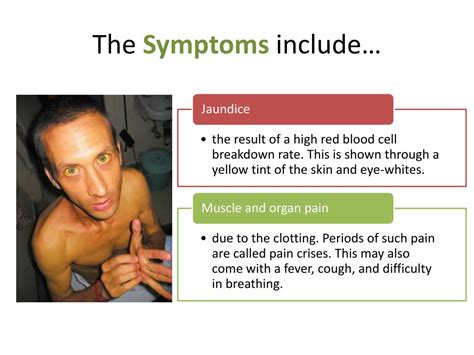 PPT - Sickle- Cell Anemia PowerPoint Presentation, free download - ID ...