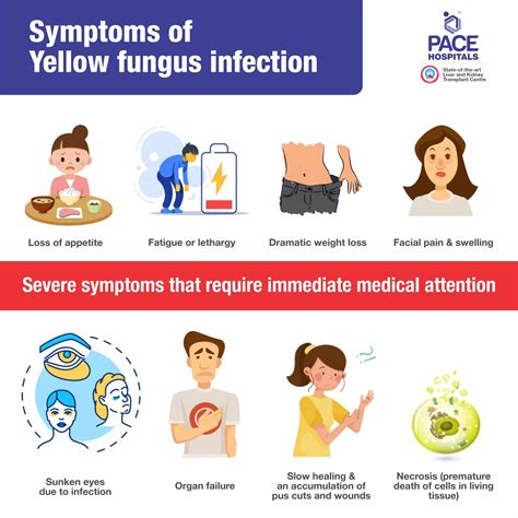 Yellow Fungus Infection: Symptoms, Risks, Causes, Diagnosis, Treatment