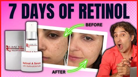 🔺RETINOL BEFORE And AFTER HALF Of HER FACE 🔺 // Retinol Serum - YouTube