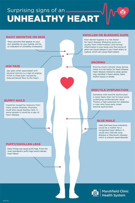 Heart Failure Symptoms Chart