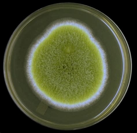 Fun With Microbiology (What's Buggin' You?): Aspergillus flavus