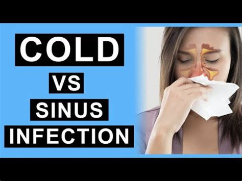 Cold vs Sinus Infection | What's the Difference? - YouTube