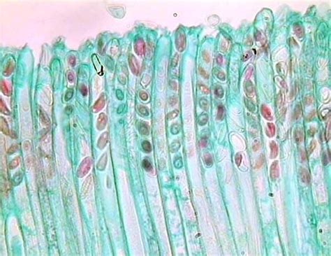 DIVISION ASCOMYCOTA Peziza (high magnification of asci containing ...