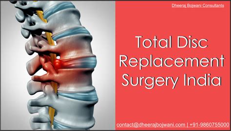 Disc replacement surgery: A way to get relief from intolerable pain ...