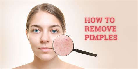 How To Get Rid Of Little Pimples - Considerationhire Doralutz