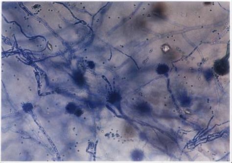 Aspergillus Slide Labeled