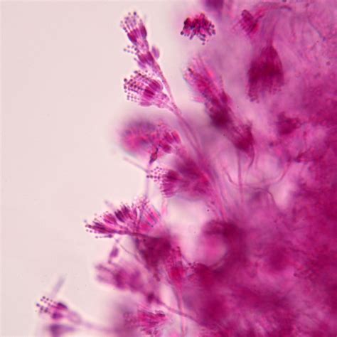 Penicillium Slide, w.m. | Carolina Biological Supply