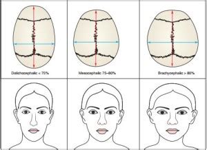 Cephalic index – Ace Achievers