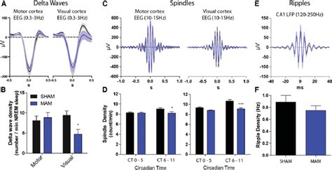 Selective Delta Wave and Spindle Abnormalities during NREM Sleep in ...