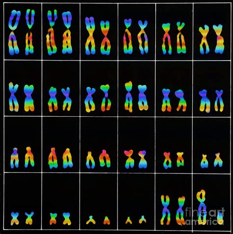 Male Karyotype Photograph by Omikron