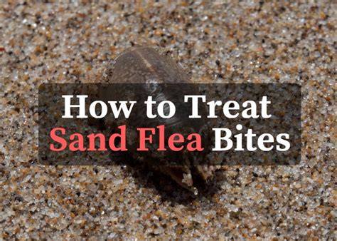 How Do You Treat Sand Fleas On Dogs