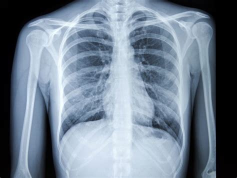 Ask Dr. M: What’s the difference between an X-ray, CT scan, ultrasound ...