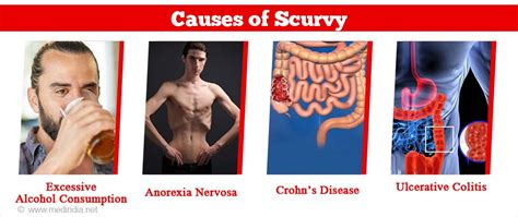 Scurvy - Causes, Symptoms, Diagnosis, Treatment & Prevention