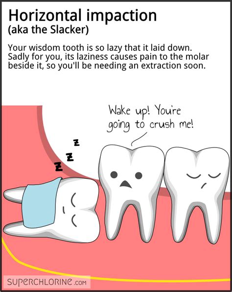 Wisdom Tooth Funny Quotes. QuotesGram