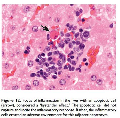 Recommendations from the INHAND Apoptosis/Necrosis Working Group ...