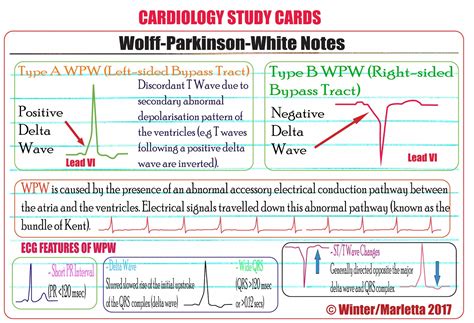 ECG Educator Blog : Wolff-Parkinson-White