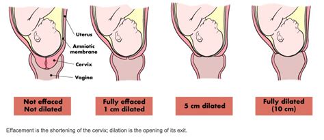 Labour - THAMES VALLEY MIDWIVES