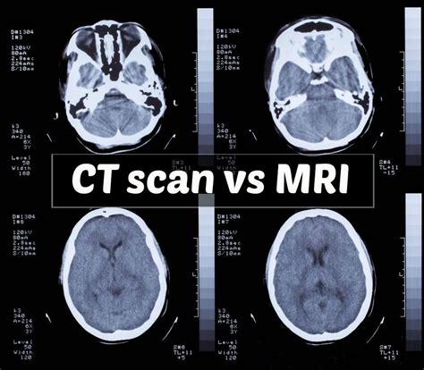 Pet Scan Vs Ct Scan Vs Mri Mcat | YOUR PET