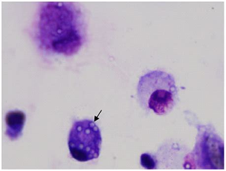 Macrophage Phagocytosis Microscope