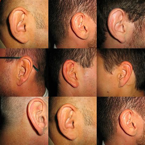 Ear Infections in Adults: Common Causes and Natural Remedies