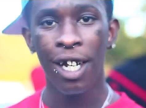 How Did Young Thug Fix His Teeth - TeethWalls