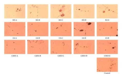 Spores of Aspergillus parasiticus grown in Czapek liquid media with ...