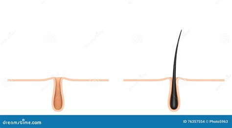 Hair Follicle. Cross Section. Stock Illustration - Illustration of ...