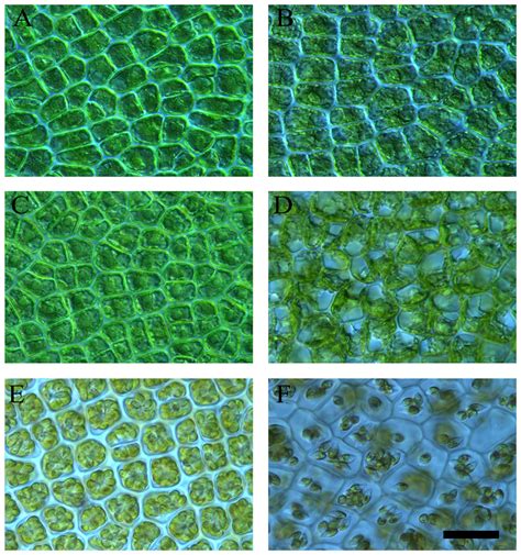 The phases of the formation of sporangia in excised disks from U ...