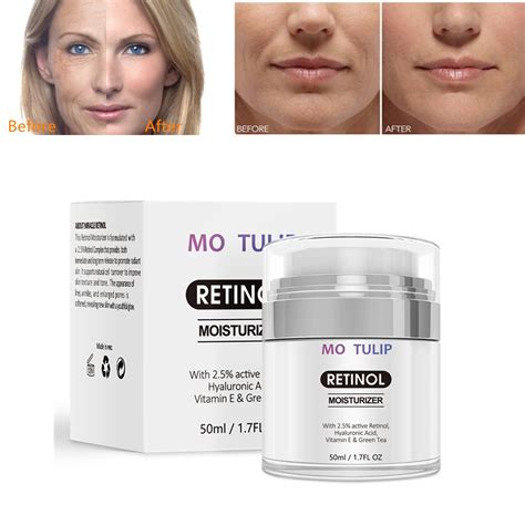 Retinol 2.5% Moisturizer Cream Anti Aging and Reduces Wrinkles and Fine ...