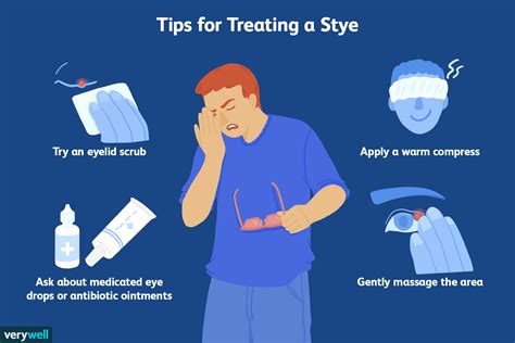 Stye on the Eyelid: Causes, Treatment, and More