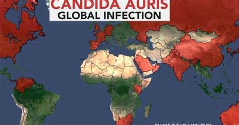 The New Fungus Outbreak 2024 - Andi Madlin