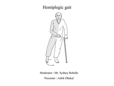 Hemiplegic gait | PPT