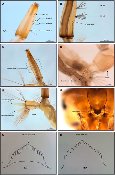 Standard morphological characters used to identify Culex... | Download ...