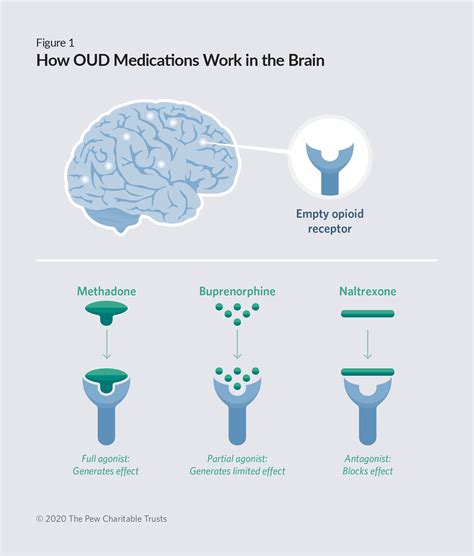 Medications for Opioid Use Disorder Improve Patient Outcomes | The Pew ...