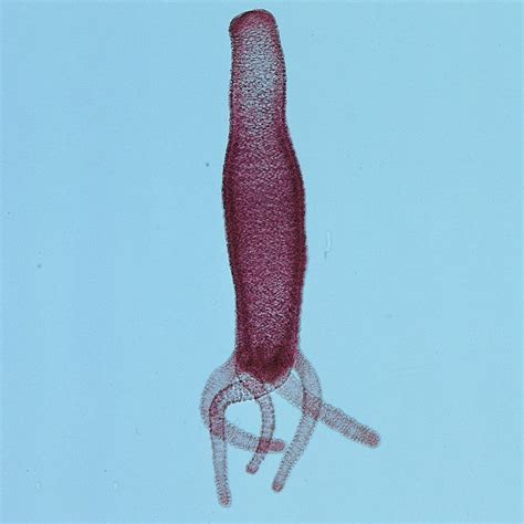 Hydra (Cnidarians) Microscope Slides | Carolina.com