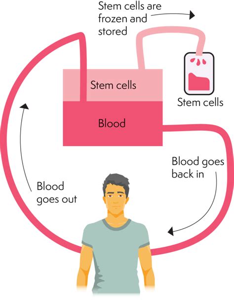 Autologous Stem cell transplant - Lymphoma Australia